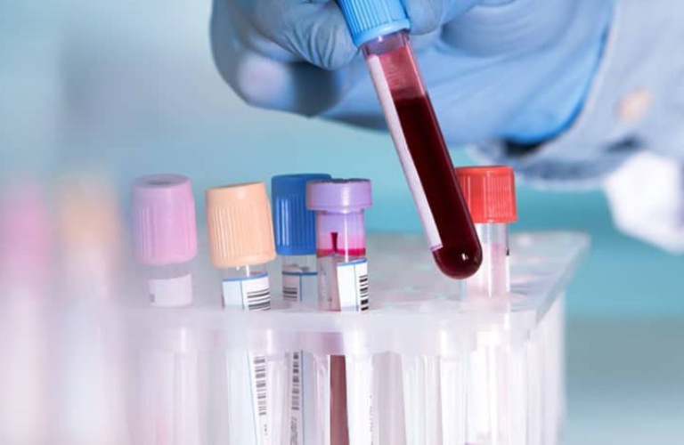 Làm xét nghiệm máu giúp chẩn đoán bệnh tương đối chính xác