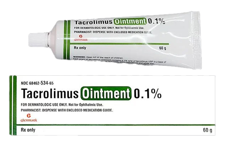 Tacrolimus có tác dụng ức chế calcineurin, cải thiện triệu chứng