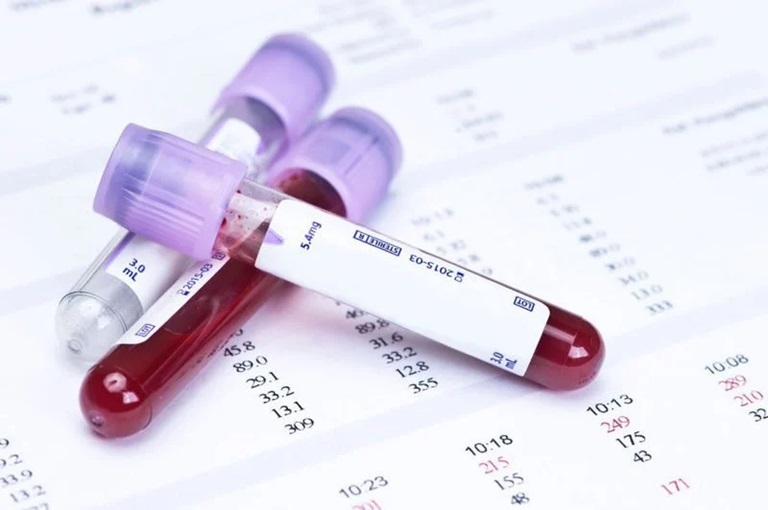 Xét nghiệm máu sẽ giúp xác định xem bạn có bị dị ứng với bất kỳ nguyên nhân nào cụ thể hay không